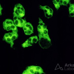 Granular Cytoplasmic Staining of C-ANCA